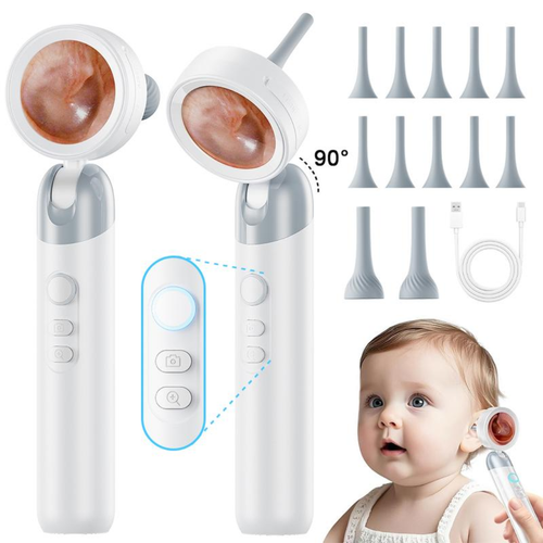 ClearView Otoscope