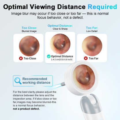 ClearView Otoscope